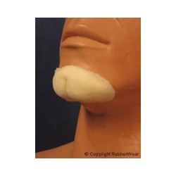Cleft Chin