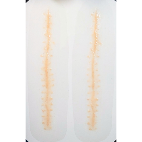 Healing long stitches