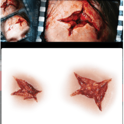 STAR INJURY