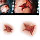 STAR INJURY (1/2)
