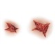 STAR INJURY (2/2)