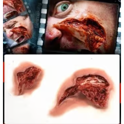 Gouge injury 