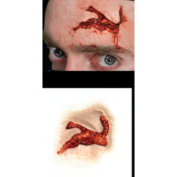 Head Wound