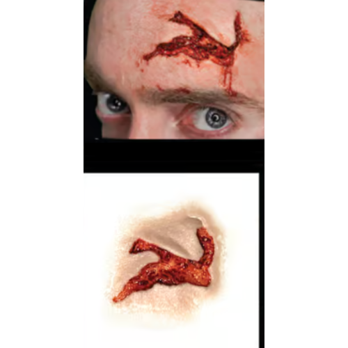 Head Wound